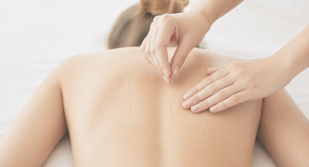 Sesión de acupuntura profesional a domicilio en Santiago